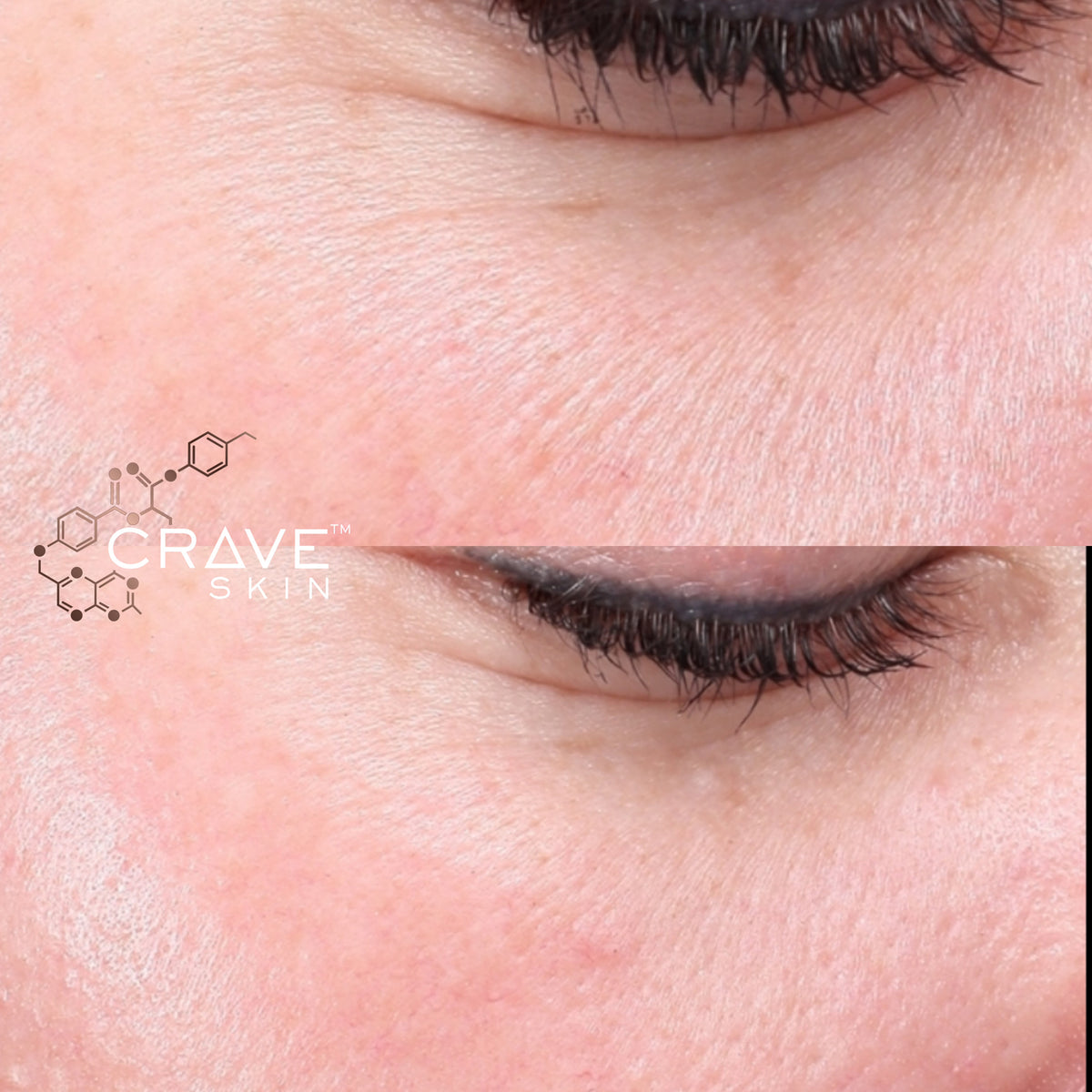 crave skin clinical results subject10 Seen improvement in wrinkles