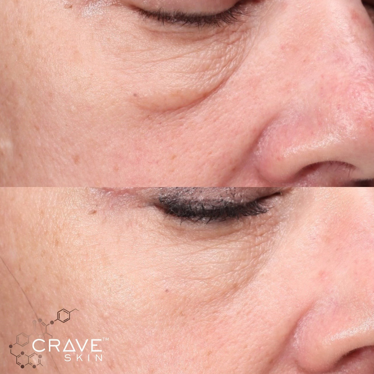 crave skin clinical results subject13 Would purchase & Recommend
