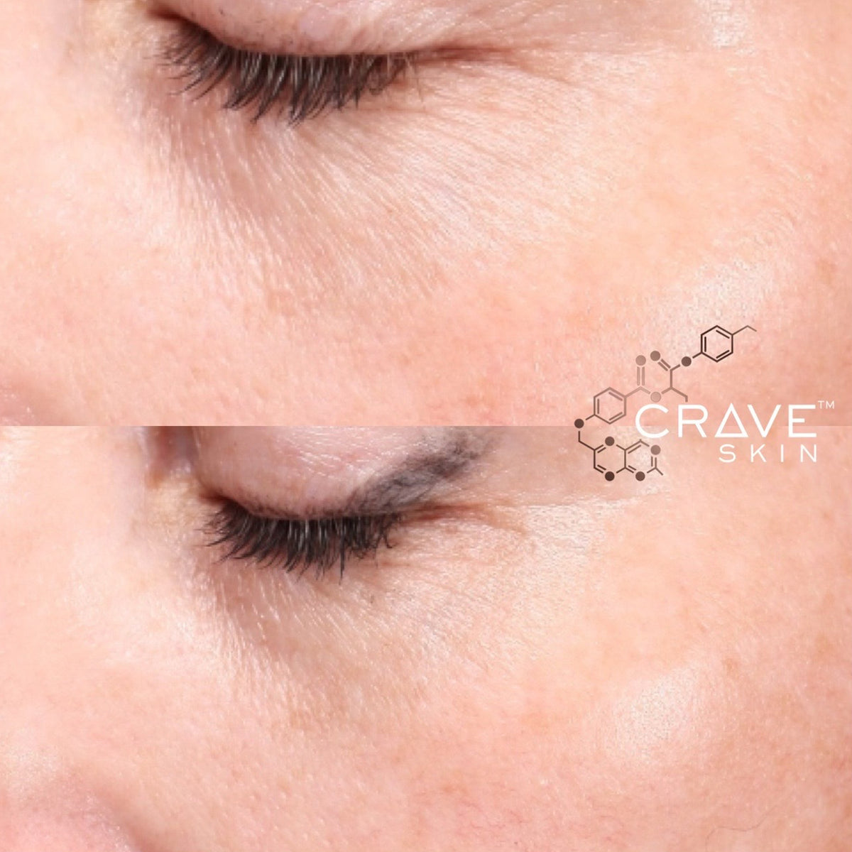 crave skin clinical results subject16 Would purchase & Recommend